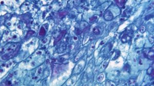 Variole du singe&nbsp;: le comité d’urgence de l’OMS va décider s’il faut placer la maladie en alerte maximale